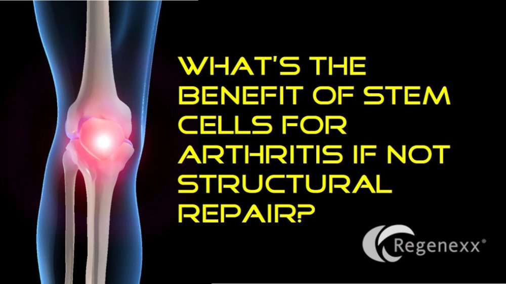 What’s the Benefit of Stem Cells for Arthritis if Not Structural Repair?