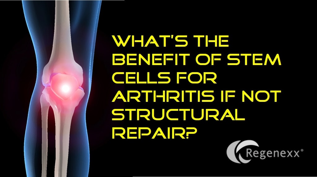 stem cells arthritis