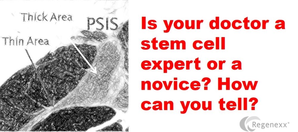 Stem Cell Treatment Reviews: Expert vs. Novice?