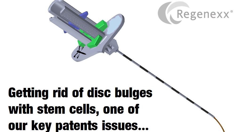 Back Pain Stem Cells: A Key Regenexx Patent Issues