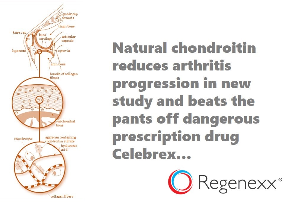 chondroitin beats arthritis