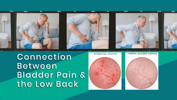 Image: Bladder pain and low back connection. Illustration showing the relationship between bladder pain and the lower back.