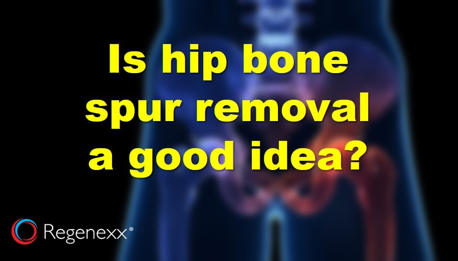 hip-bone-spur-removal