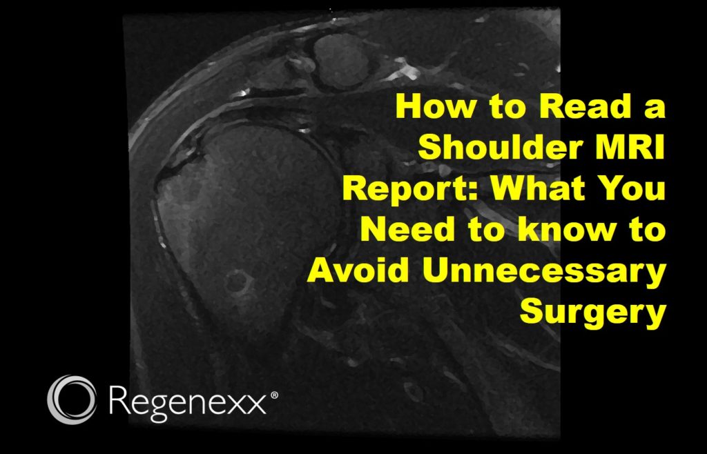 Image of shoulder MRI with text overlay that reads 