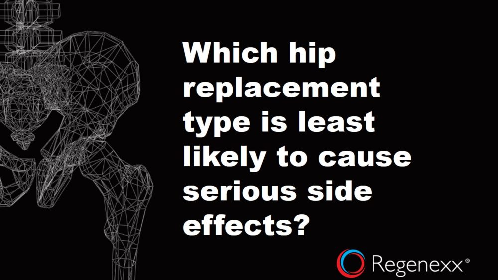 Hip Replacement Materials – A Complete Guide to the Best and Worst