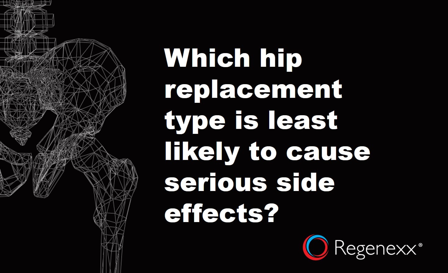 Hip Replacement Materials - The Best & Worst Kinds To Use