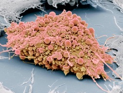 Adult Mesenchymal Stem Cell