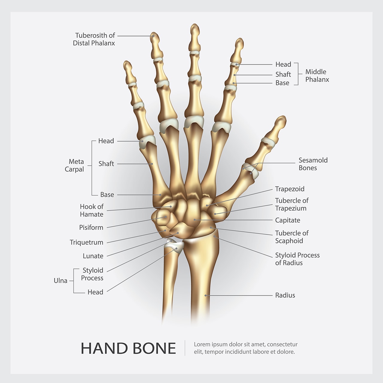 Wrist Replacement Success Rates Confirm: Surgery Not the Answer