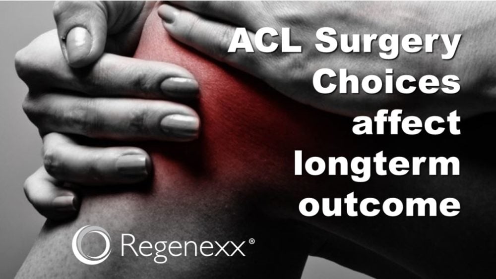 ACL Surgery Choices: A Tale of Two Grafts