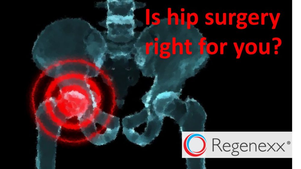 Hip Surgery Results: Little Evidence the Procedure Works