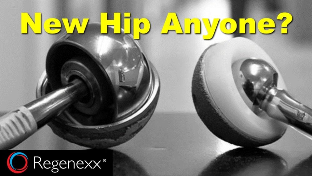 Are Hip Replacement Complications from M.O.M Hip Implants a Roll of the Dice?