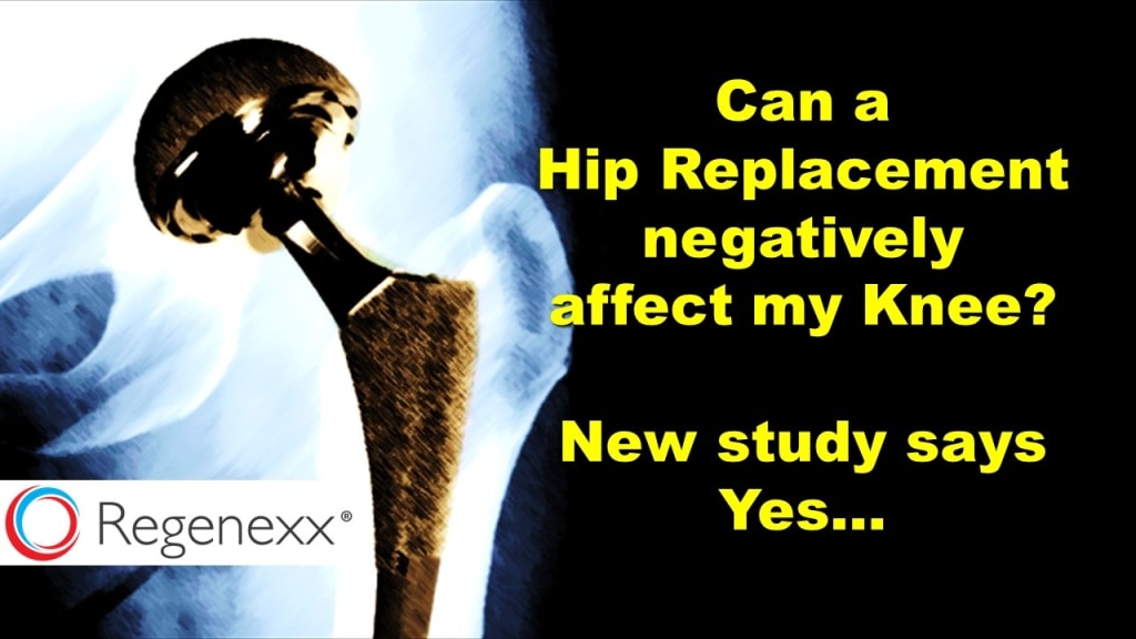 Hip Replacement Risks Include Disrupting Hip And Knee Alignment Regenexx®