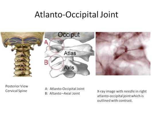 alar ligament treatment