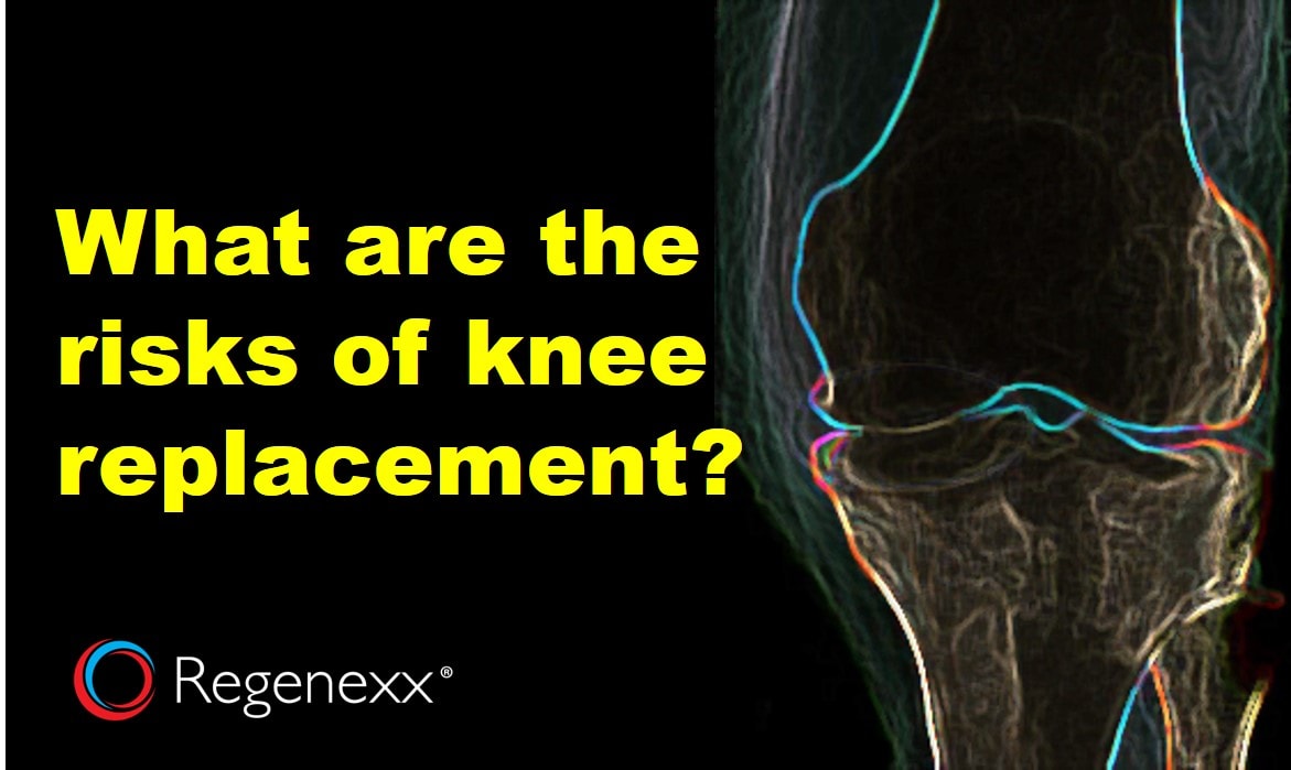 What Are Knee Replacement Risks An Update Regenexx®