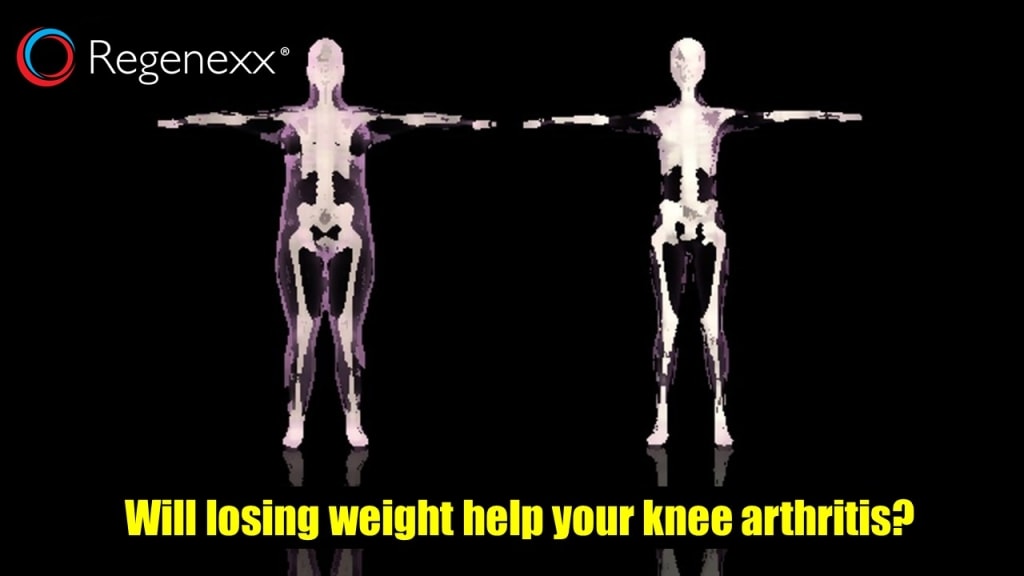 overweight with knee pain