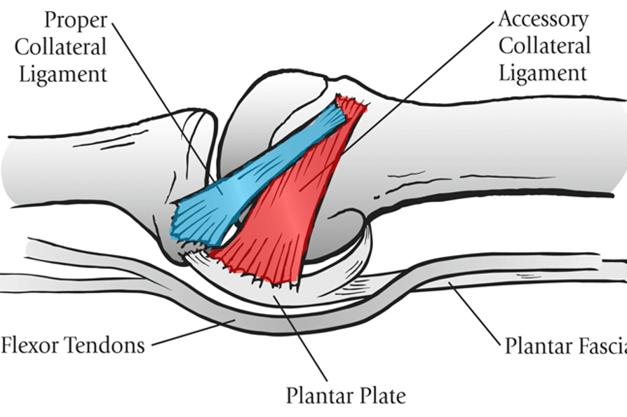 plantar plate ligaments