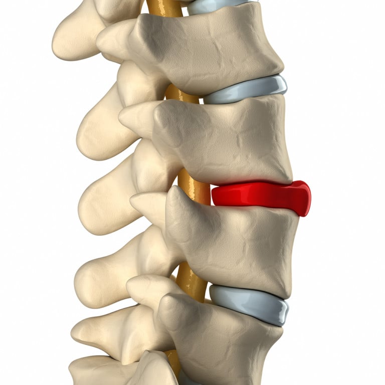 unable-to-sit-with-sciatica-try-taking-a-walk-regenexx