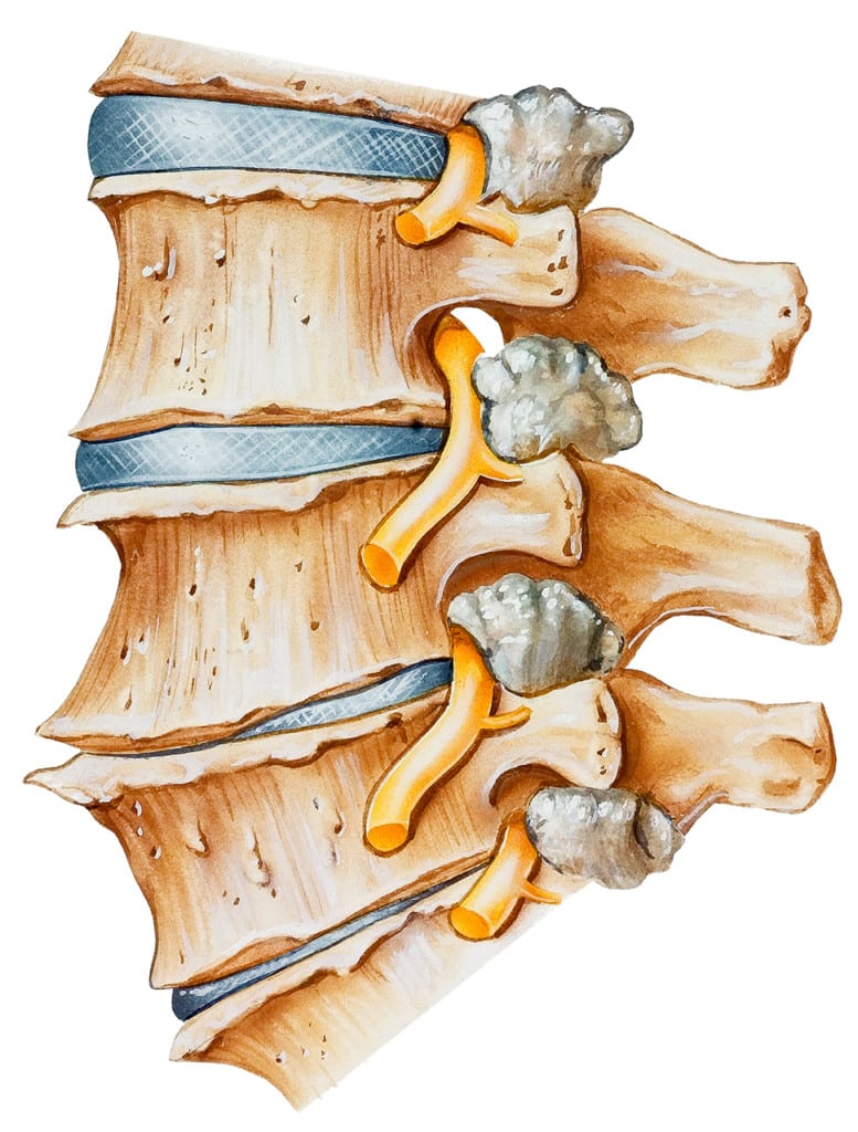 stem cells for disc regeneration