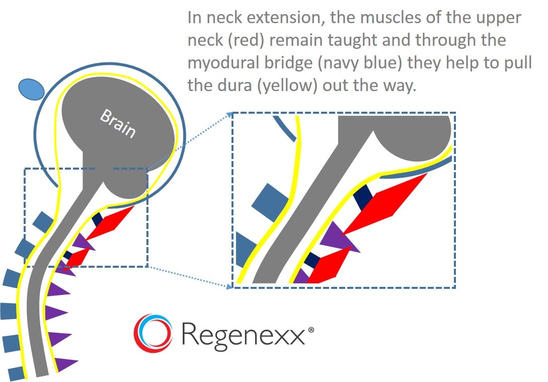 Myodural bridge in neck extension
