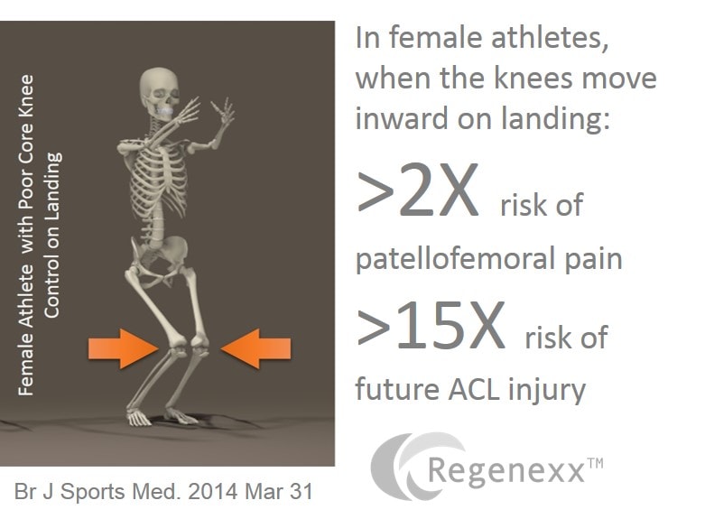 acl-injury-causes