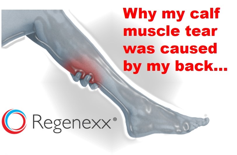 Calf Muscle Tendon Tear