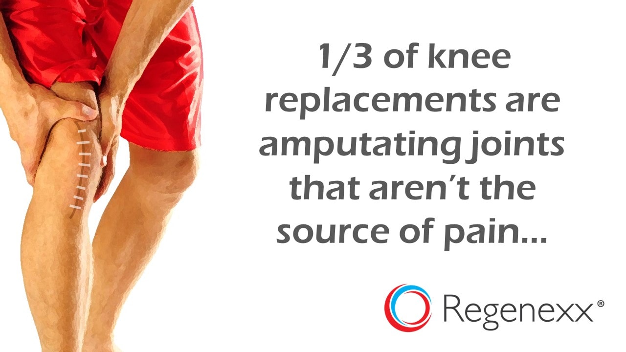 Chronic Knee Replacement Pain 1/3 of the Time Knee Replacement Surgery