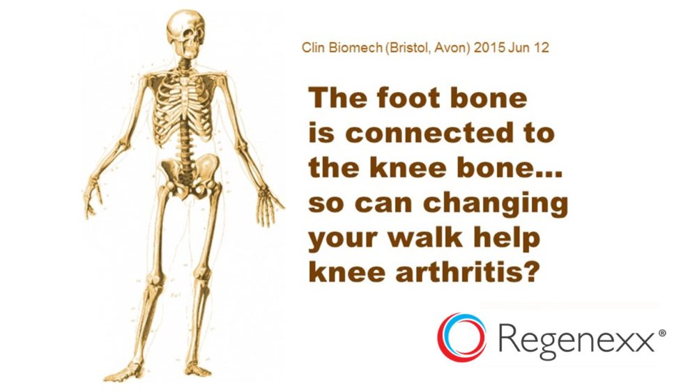 Changing Your Walk May Help Your Knee Arthritis