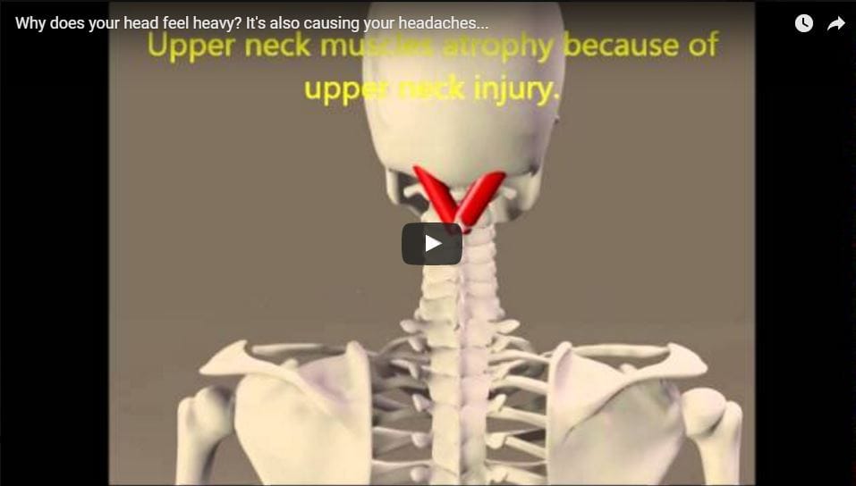 why-your-head-feels-heavy-weak-upper-neck-muscles-may-also-be-causing