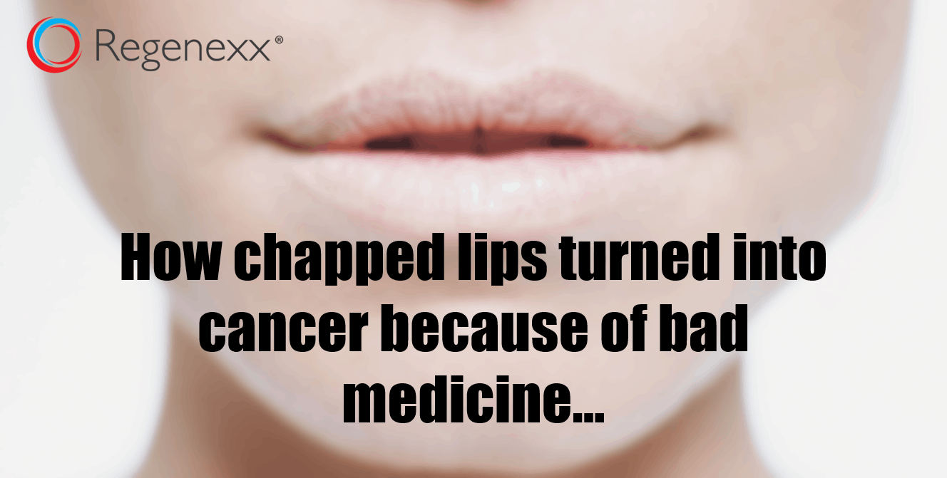Bad Medicine How a Cracked Lip Turned into Cancer Regenexx®