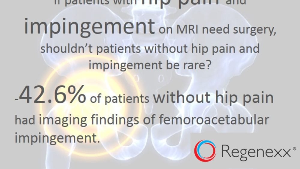 Worrying about Hip Impingement Surgery Recovery? Loads of Patients without Pain Have Hip Impingement
