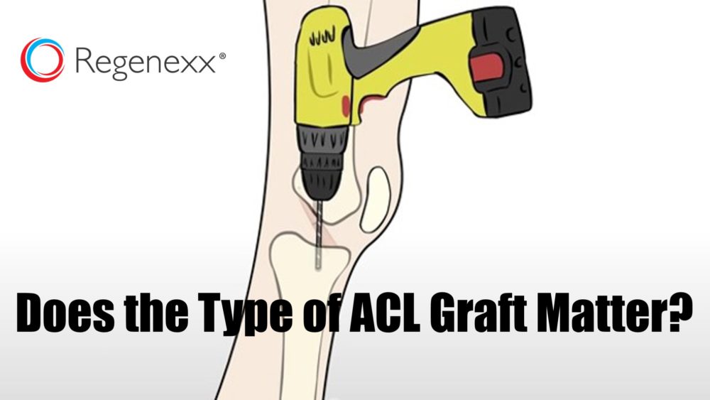 Knee ACL Surgery Graft Choices: Someone Else’s ACL has Three Times the Failure Rate!