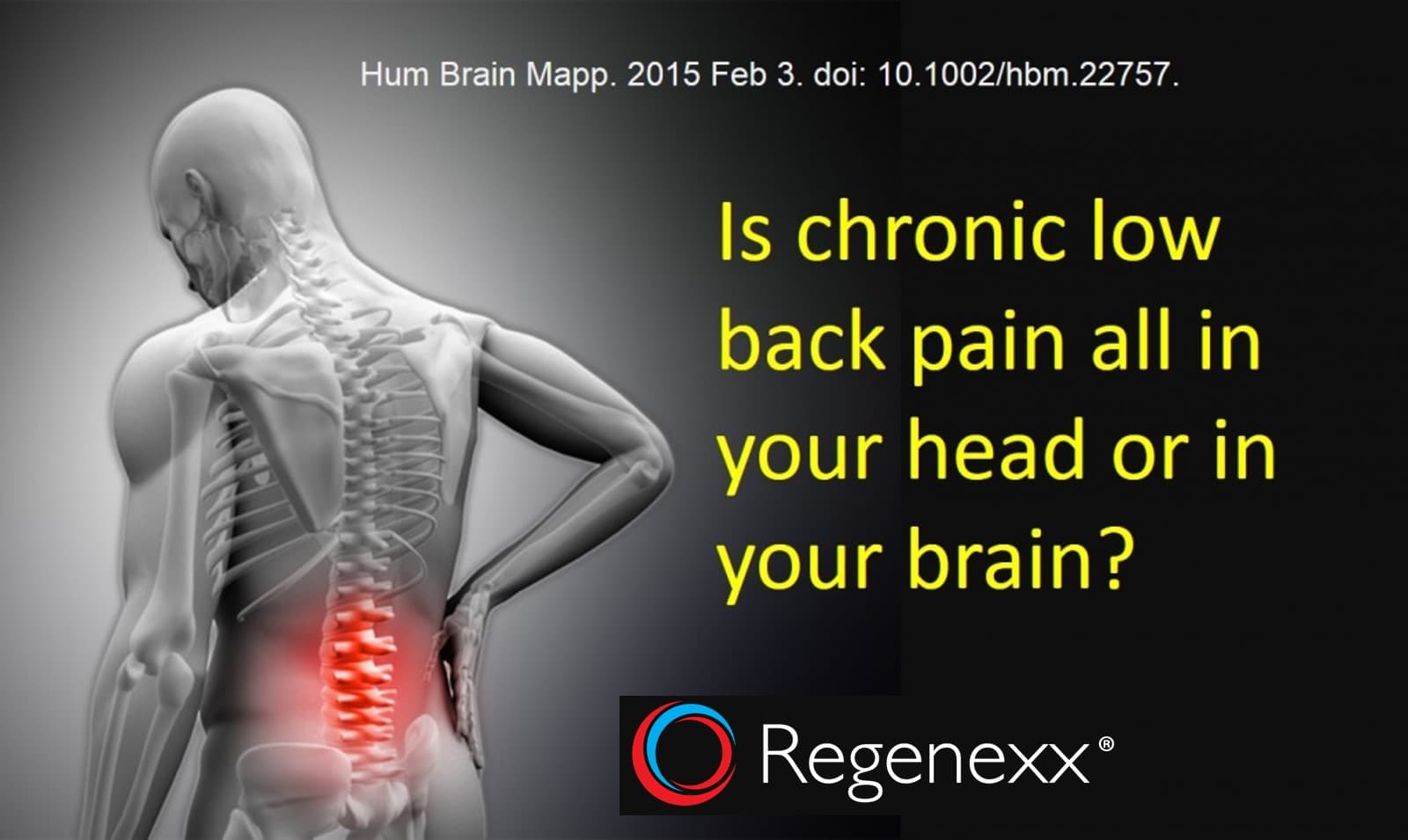 Chronic Low Back Pain is in Your Back and in Your Brain