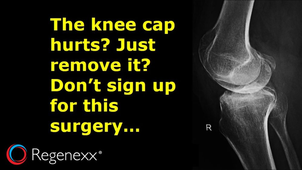 Knee Cap Hurts? Just Cut It Out!