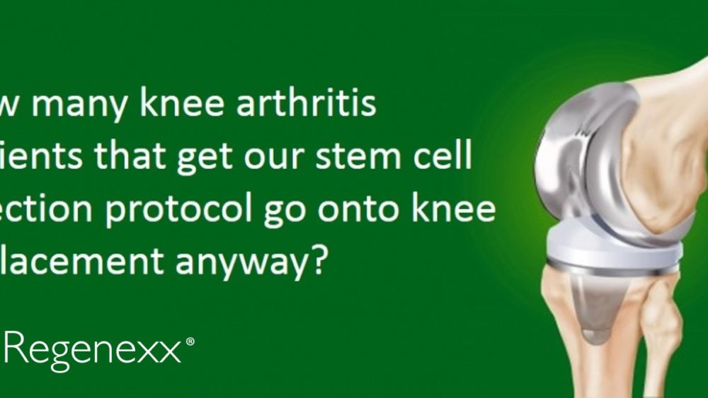 How Many Stem Cell Patients Convert to Knee Replacement?