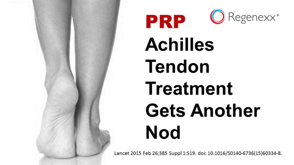 PRP Achilles Tendon Treatment Studied…