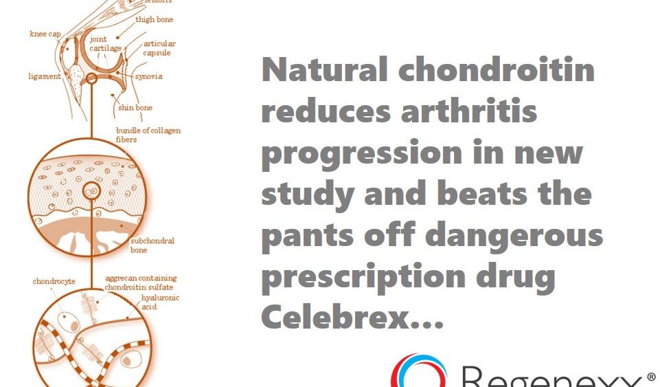Chondroitin Better Than Celebrex in Study!
