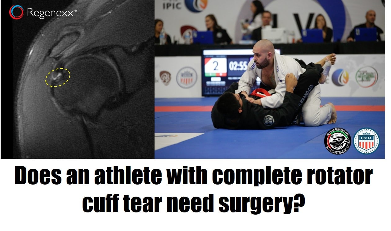 how to avoid surgery for rotator cuff