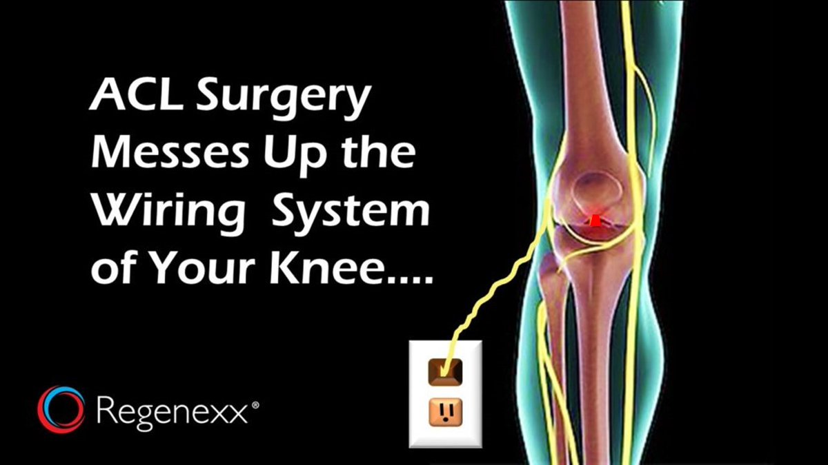 long-term-effects-of-acl-reconstruction-surgery-regenexx