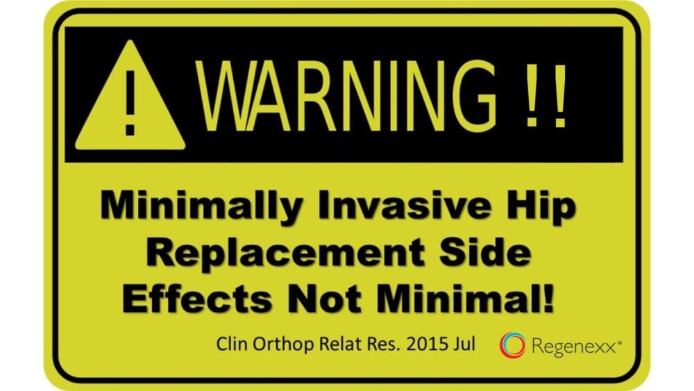 Minimally Invasive Hip Replacement has Maximum Side Effects!