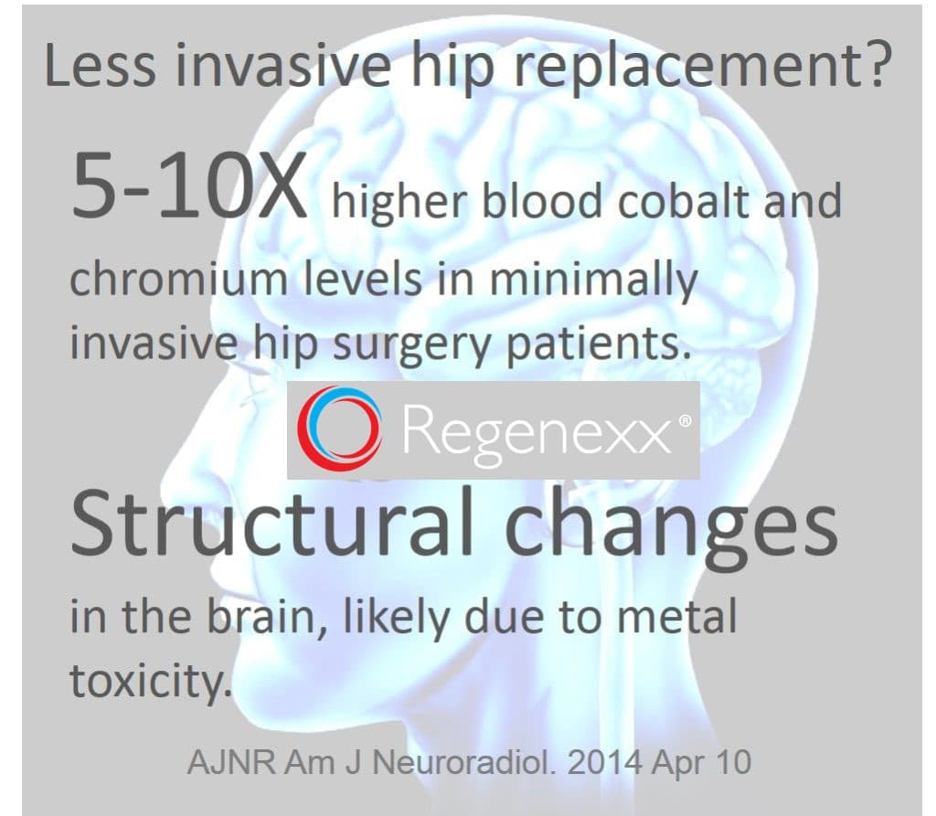 Less Invasive Hip Replacement? Metal Toxicity and Brain Changes in Hip