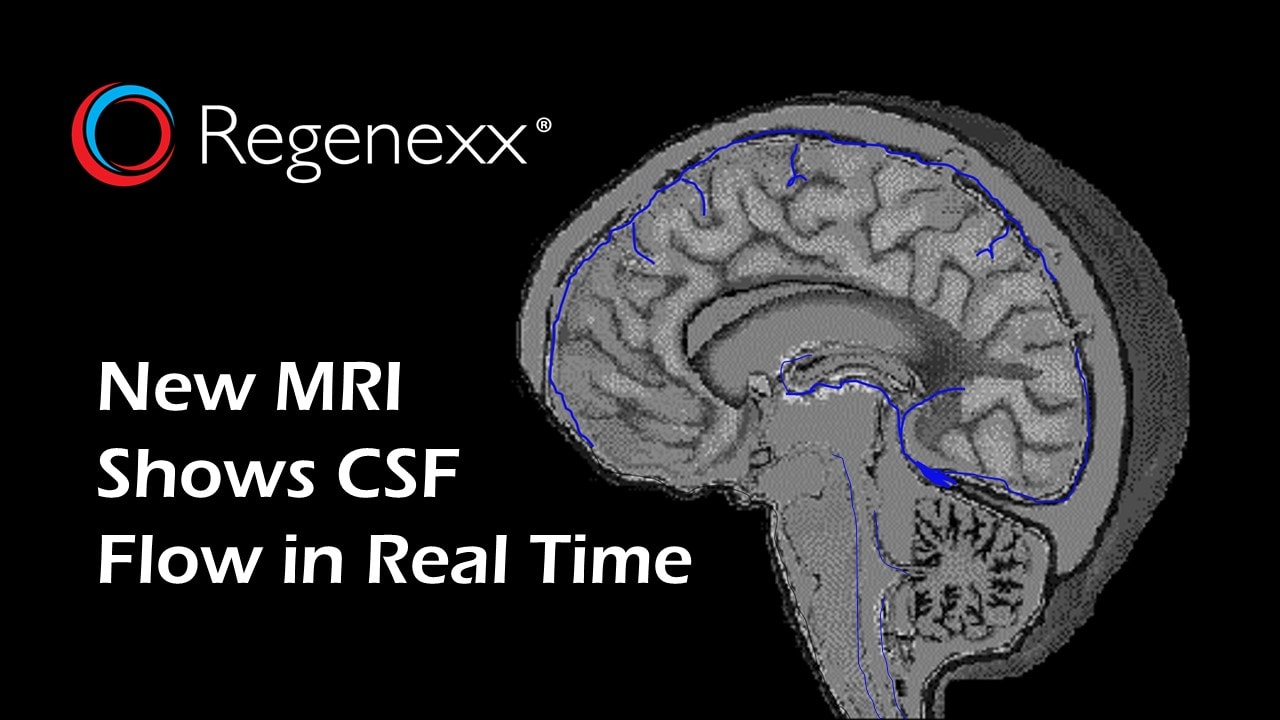 What Is Mri Csf Flow Study