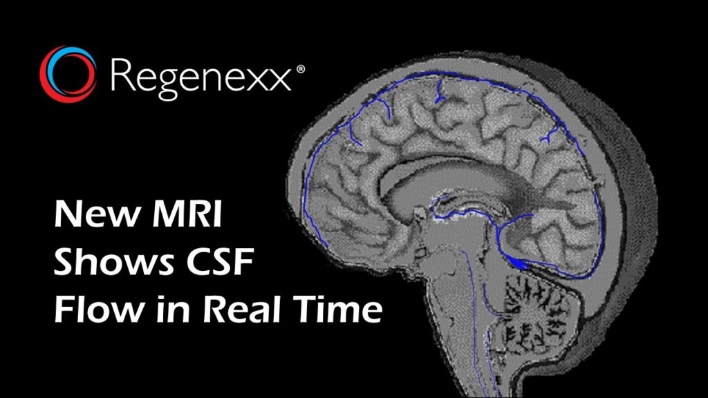 Csf Flow Study Mri Protocol Philips