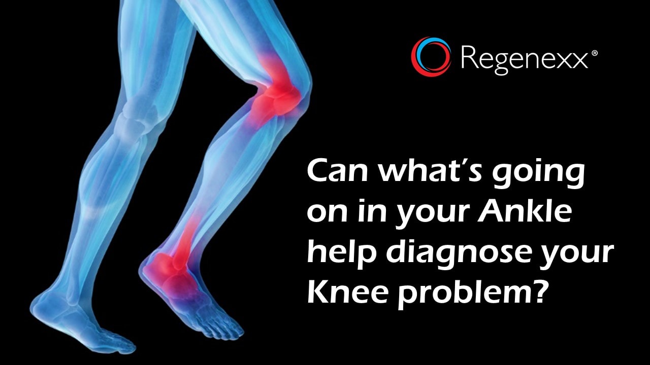 the Knee Bone's Connected to the Ankle Bone - Regenexx Blog