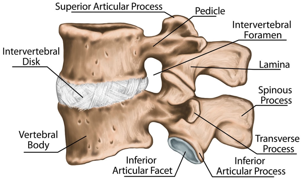 what-is-foraminal-stenosis