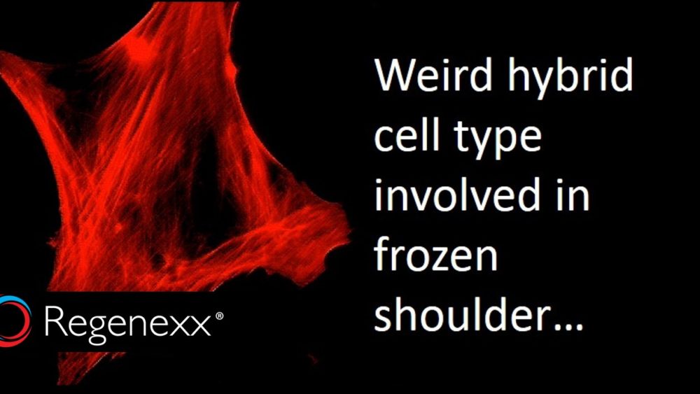 Adhesive Capsulitis Treatment: What is a Myofibroblast?