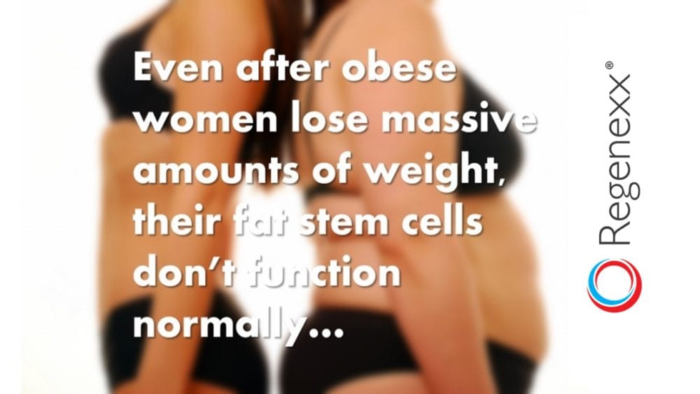 Heavier Patients Permanently Damage Fat Stem Cells