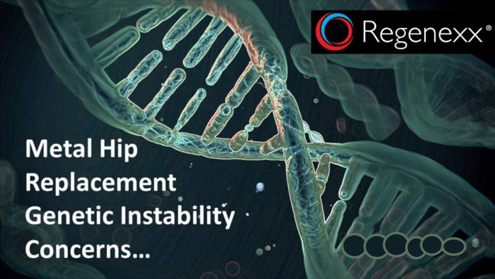 Metal Hip Replacement Genetic Instability: Round 2…