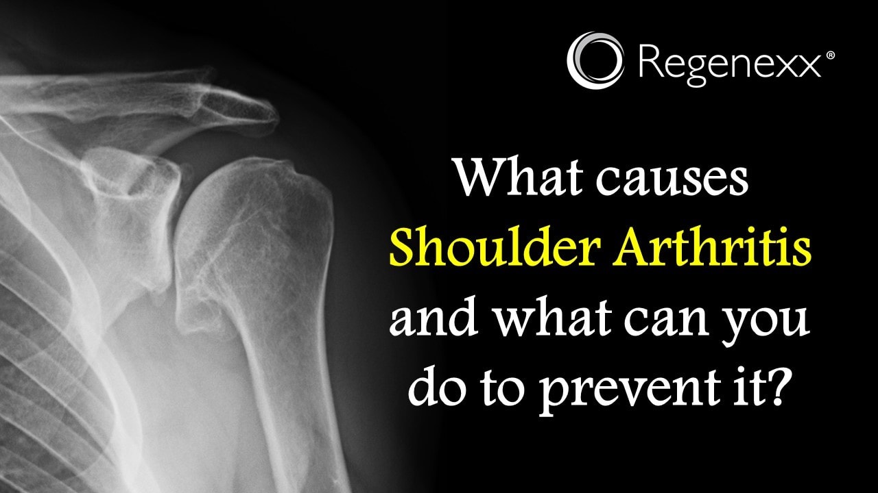 what-causes-shoulder-arthritis-regenexx