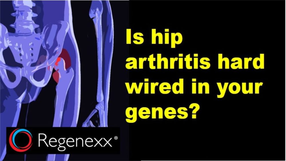 Is Hip Arthritis Genetic? Probably…