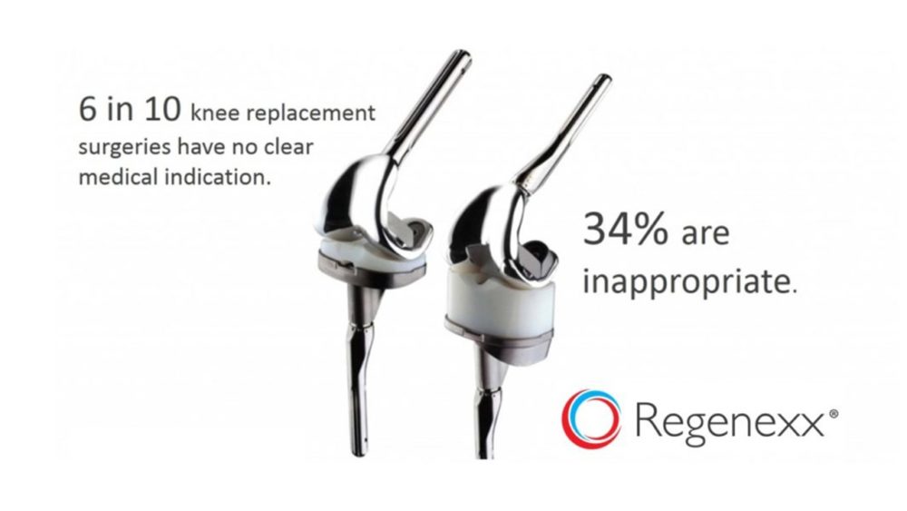One Third of Knee Replacements Are Unnecessary